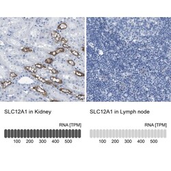 NKCC2/SLC12A1 Antibody, Novus Biologicals:Antibodies:Primary Antibodies